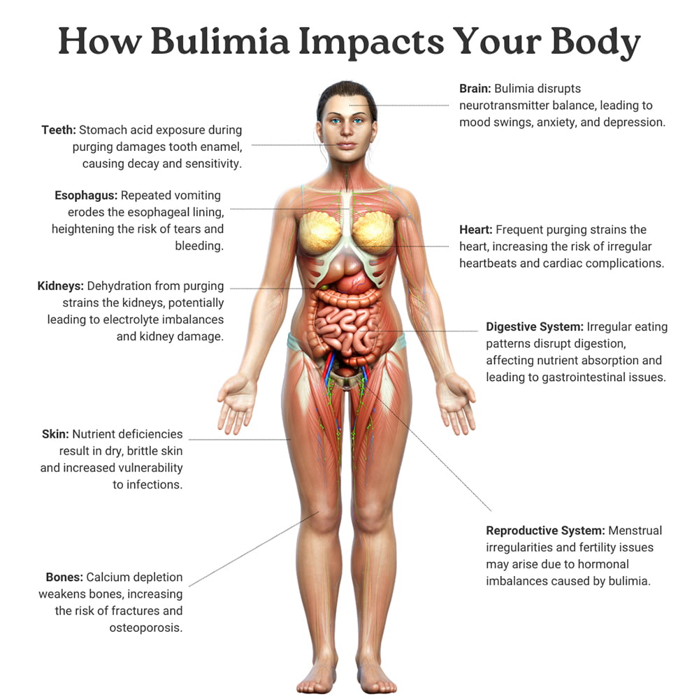 How Bulimia Impacts Your Body